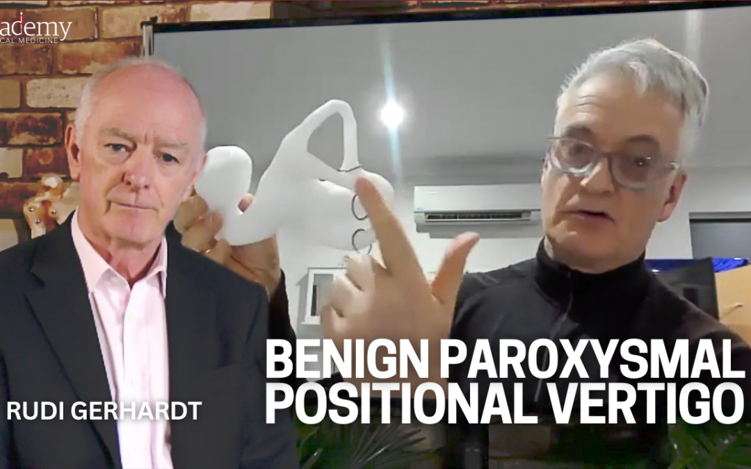 Benign Paroxysmal Positional Vertigo