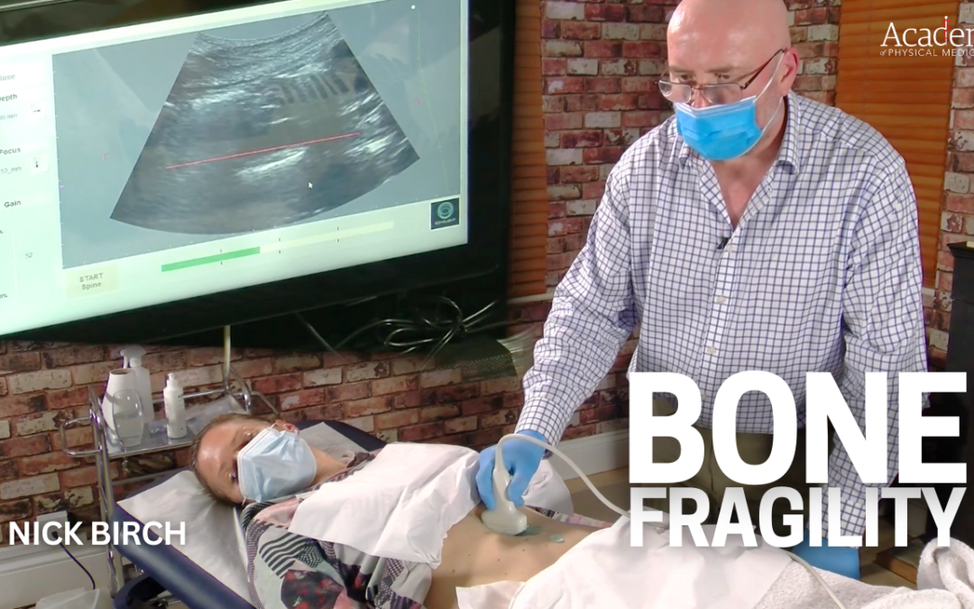 Bone Fragility