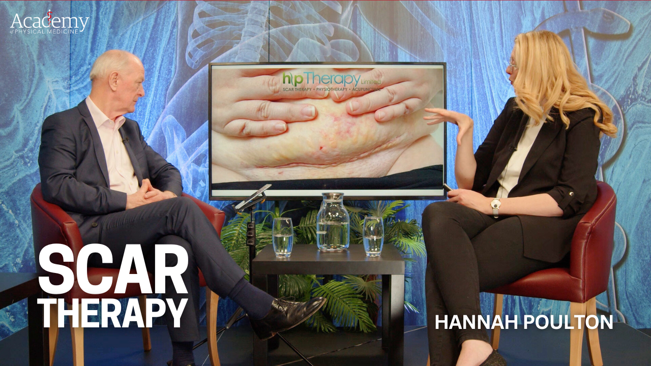 Scar Therapy